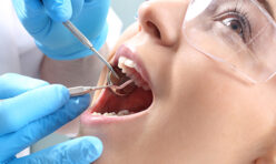 Dental Cleaning and Fluoride Treatments