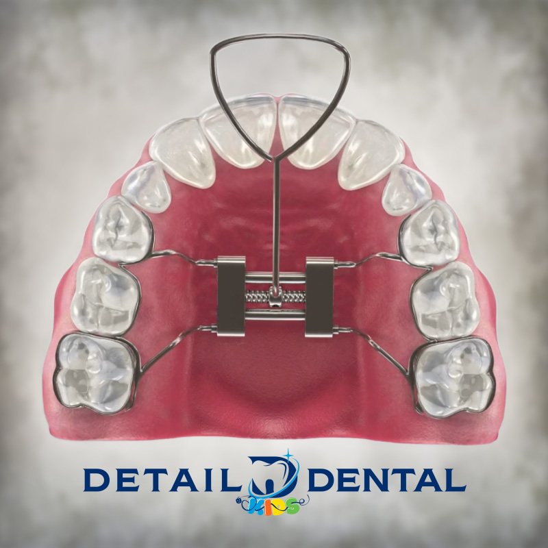 Developmental & Orthodontic Treatment with Palatal Expanders Detail